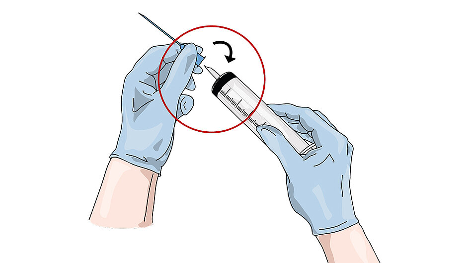 Hand in gloves, attaching needle to syringe.